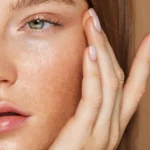 Huidverjonging | Gelaat